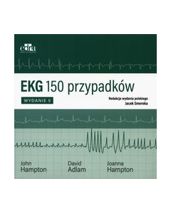 EKG 150 przypadków