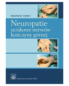 Neuropatie uciskowe nerwów kończyny górnej