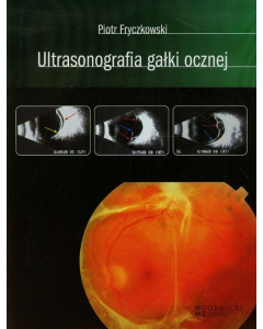 Ultrasonografia gałki ocznej