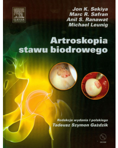 Artroskopia stawu biodrowego +dvd