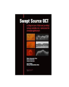 Swept Source OCT