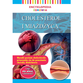 Encyklopedia zdrowia Cholesterol i miażdżyca