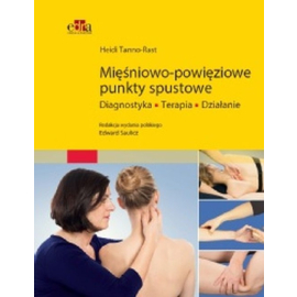Mięśniowo-powięziowe punkty spustowe