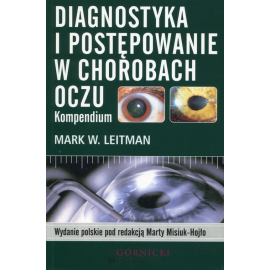 Diagnostyka i postępowanie w chorobach oczu