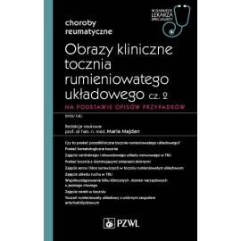 Obrazy kliniczne tocznia rumieniowatego układowego Część 2