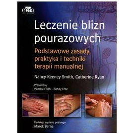 Leczenie blizn pourazowych