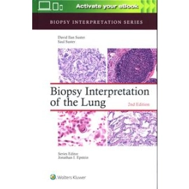 Biopsy Interpretation of the Lung Second edition
