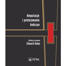 Amputacje i protezowanie kończyn