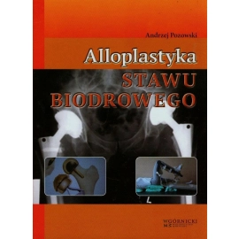 Alloplastyka stawu biodrowego