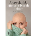 Alopecjanki. Historie łysych kobiet